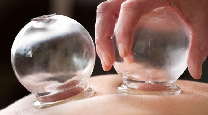 Cupping & Moxibustion