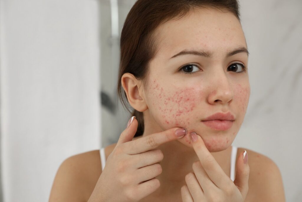 woman with skin issue